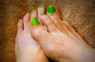 Read more about the article Ingrown Toenail