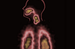 Read more about the article Divine Respiratory Treatment