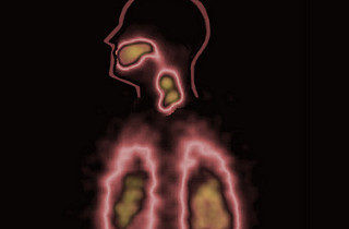 Divine Respiratory Treatment 9 - The Crossover Project 5346606172 d301311d9a n e1474491331337 - The Crossover Project