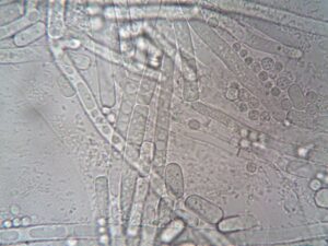 Close-up image of fungal hyphae under microscope showcasing biological structures.
